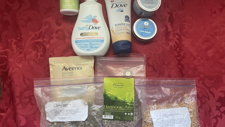 Treat Eczema At Home